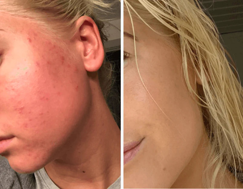 Emily before and after