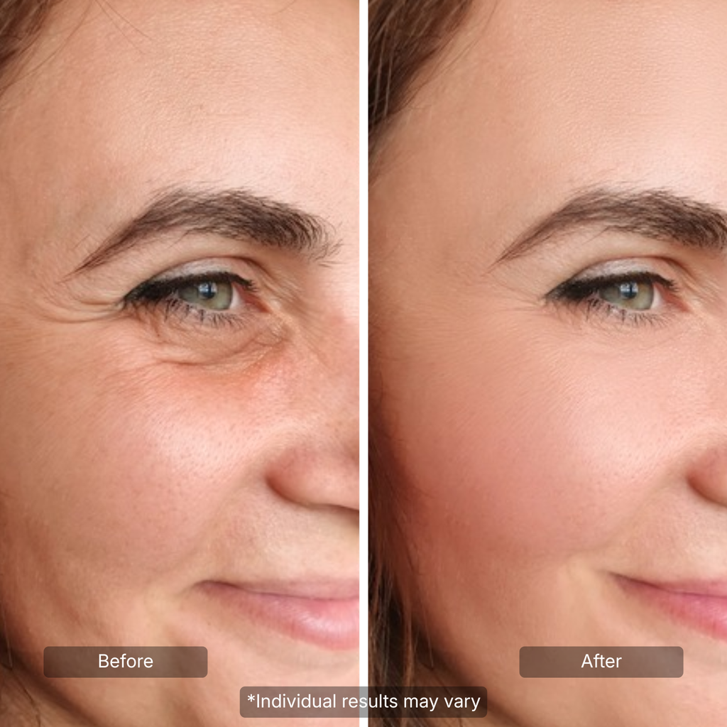 Line Smoother Targeted Fine Line Filler