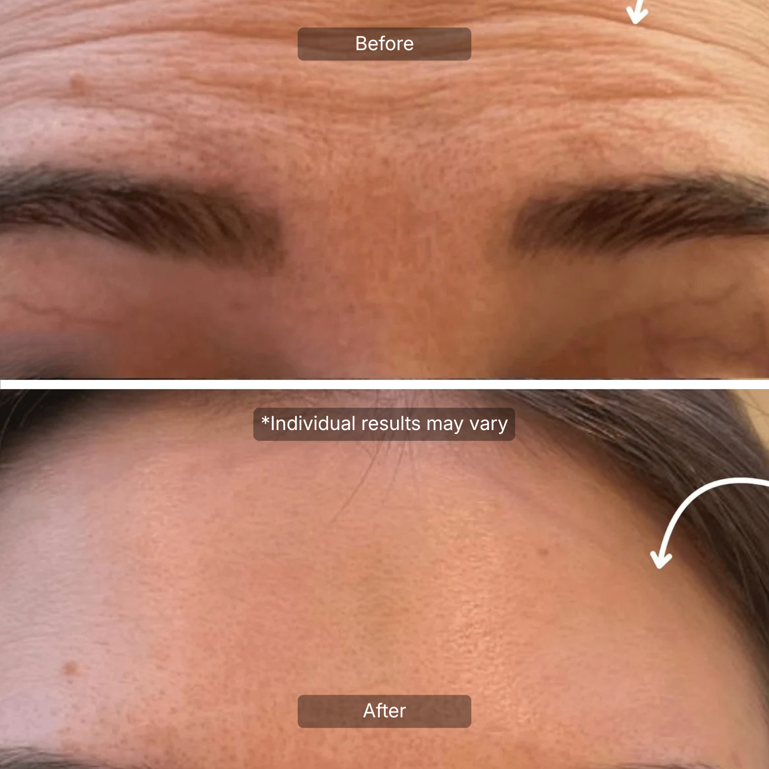 Line Smoother Targeted Fine Line Filler