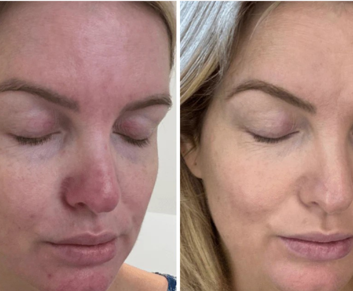 Katie before and after