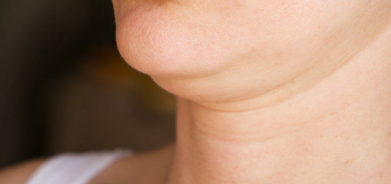 Double Chin